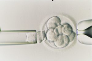 Preimplantation Genetic Screening For All? Is It Wrong To Do Genetic Testing On All IVF Embryos? 2