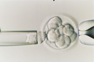 preimplantation testing for IVF