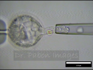 IVF statistics of embryo transfer results (Dr. Pabon's image)