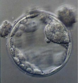 Photo of euploid blastocyst transfer
