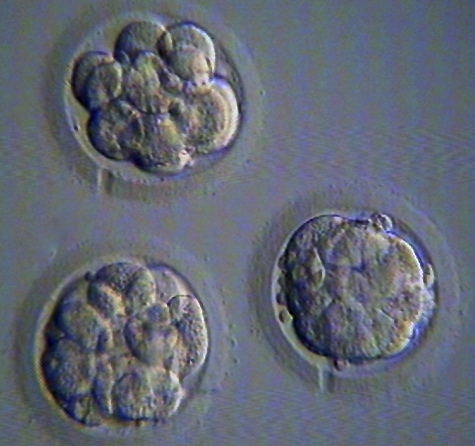 photo multicellular day 3 embryo