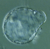 Preimplantation Testing for IVF: A blastocyst (day 5 or 6 embryo) showing the herniating trophectoderm ready for biopsy.