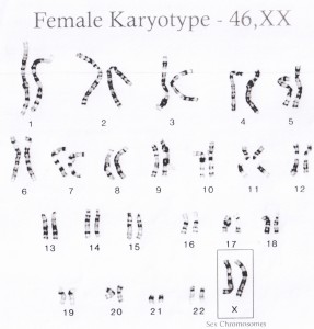 Female Karyotype chart - 46, XX