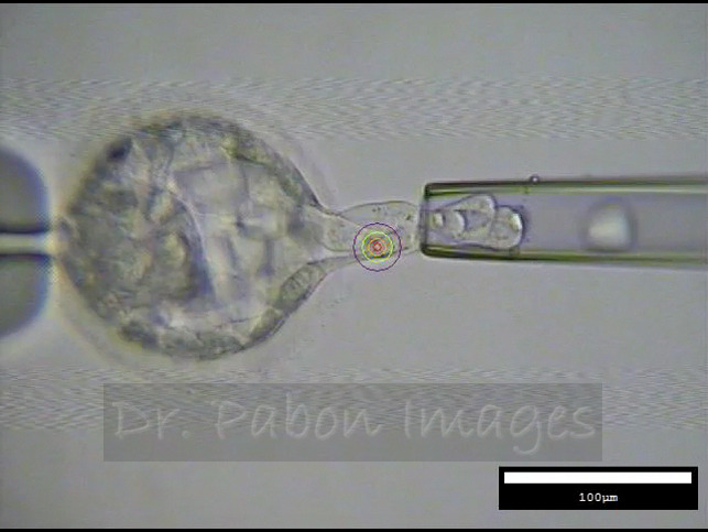 Blastocyst Biopsy, microscopic image by Dr. Pabon